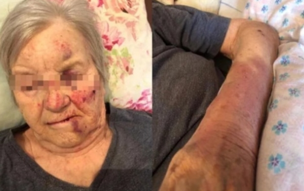 Следком проверит факт избиения 78-летней пенсионерки в новосибирском